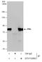 Promyelocytic Leukemia antibody, GTX112996, GeneTex, Immunoprecipitation image 