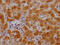 Complement C3 antibody, CSB-RA699863A0HU, Cusabio, Immunohistochemistry paraffin image 