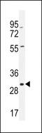 Coatomer Protein Complex Subunit Epsilon antibody, MBS9206862, MyBioSource, Western Blot image 