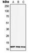 Transforming Growth Factor Alpha antibody, LS-C353801, Lifespan Biosciences, Western Blot image 