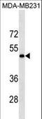 Protein-lysine 6-oxidase antibody, LS-C157868, Lifespan Biosciences, Western Blot image 