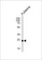 Complement Factor D antibody, MBS9203258, MyBioSource, Western Blot image 