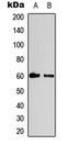Cycb1 antibody, GTX55051, GeneTex, Western Blot image 