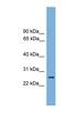 RAB35, Member RAS Oncogene Family antibody, NBP1-79484, Novus Biologicals, Western Blot image 