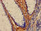 Mitogen-Activated Protein Kinase Kinase Kinase 7 antibody, LS-C396976, Lifespan Biosciences, Immunohistochemistry paraffin image 