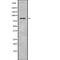 Zinc Finger And BTB Domain Containing 17 antibody, PA5-67999, Invitrogen Antibodies, Western Blot image 