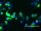 Mucin 1, Cell Surface Associated antibody, LS-C175486, Lifespan Biosciences, Immunofluorescence image 