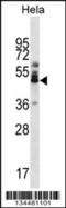 Zinc Finger Protein 174 antibody, 57-804, ProSci, Western Blot image 