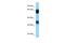 Alpha-1,6-Mannosylglycoprotein 6-Beta-N-Acetylglucosaminyltransferase B antibody, A08123, Boster Biological Technology, Western Blot image 