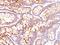 Carcinoembryonic Antigen Related Cell Adhesion Molecule 5 antibody, NBP2-44902, Novus Biologicals, Immunohistochemistry paraffin image 