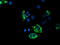 Acyl-CoA Synthetase Family Member 2 antibody, TA504711, Origene, Immunofluorescence image 