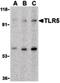 Toll Like Receptor 5 antibody, orb87371, Biorbyt, Western Blot image 