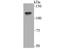 Ubiquitin Specific Peptidase 7 antibody, NBP2-75703, Novus Biologicals, Western Blot image 