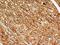 Bone Marrow Stromal Cell Antigen 2 antibody, NBP2-29622, Novus Biologicals, Immunohistochemistry paraffin image 