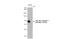 Glycogen Synthase 1 antibody, GTX03196, GeneTex, Western Blot image 