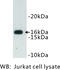 CD247 Molecule antibody, MBS355180, MyBioSource, Western Blot image 