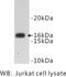 CD247 Molecule antibody, MBS355180, MyBioSource, Western Blot image 