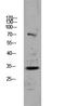 Cyclin Dependent Kinase Inhibitor 3 antibody, A05157-2, Boster Biological Technology, Western Blot image 