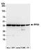 67 kDa laminin receptor antibody, A305-298A, Bethyl Labs, Western Blot image 