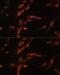 Gamma-Aminobutyric Acid Type A Receptor Gamma1 Subunit antibody, GTX66238, GeneTex, Immunofluorescence image 