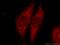 Immediate-early protein CL-6 antibody, 22115-1-AP, Proteintech Group, Immunofluorescence image 