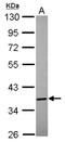 Annexin A8 antibody, NBP2-15411, Novus Biologicals, Western Blot image 