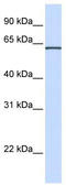 Integrin Alpha FG-GAP Repeat Containing 1 antibody, TA339563, Origene, Western Blot image 