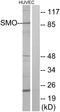 Smoothened, Frizzled Class Receptor antibody, LS-B4911, Lifespan Biosciences, Western Blot image 