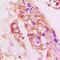 Stathmin 1 antibody, LS-C358870, Lifespan Biosciences, Immunohistochemistry frozen image 