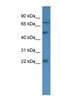 Guanylate Cyclase Activator 1B antibody, NBP1-79774, Novus Biologicals, Western Blot image 