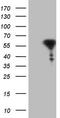 Retinoic acid receptor alpha antibody, CF806459, Origene, Western Blot image 