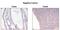 TNF Receptor Superfamily Member 10a antibody, NBP2-80069, Novus Biologicals, Immunohistochemistry paraffin image 
