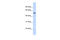 GTP Binding Protein 10 antibody, 25-804, ProSci, Western Blot image 