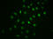 NFKB Inhibitor Alpha antibody, CSB-RA015761A32phHU, Cusabio, Immunofluorescence image 