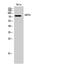 ABCD1 antibody, A01205, Boster Biological Technology, Western Blot image 