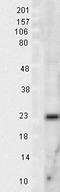 Superoxide Dismutase 2 antibody, LS-C229522, Lifespan Biosciences, Western Blot image 