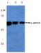 Peroxisome Proliferator Activated Receptor Gamma antibody, PA5-36763, Invitrogen Antibodies, Western Blot image 