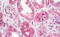 Prostate Stem Cell Antigen antibody, MBS248389, MyBioSource, Immunohistochemistry paraffin image 