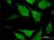 2,4-Dienoyl-CoA Reductase 2 antibody, H00026063-M03, Novus Biologicals, Immunofluorescence image 