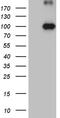Kinesin Family Member 6 antibody, M08452, Boster Biological Technology, Western Blot image 