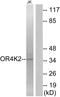 Olfactory Receptor Family 4 Subfamily K Member 2 antibody, A17553, Boster Biological Technology, Western Blot image 