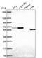 Asparagine Synthetase (Glutamine-Hydrolyzing) antibody, PA5-66714, Invitrogen Antibodies, Western Blot image 
