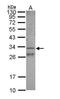 Growth Differentiation Factor 15 antibody, PA5-29782, Invitrogen Antibodies, Western Blot image 