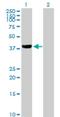 ZFP28 Zinc Finger Protein antibody, H00140612-B01P, Novus Biologicals, Western Blot image 