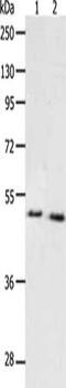 Peroxisome Proliferator Activated Receptor Alpha antibody, CSB-PA945095, Cusabio, Western Blot image 
