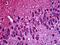 Tubulin Beta 3 Class III antibody, 48-003, ProSci, Immunohistochemistry paraffin image 