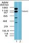 Thyroid Hormone Receptor Associated Protein 3 antibody, orb87643, Biorbyt, Western Blot image 