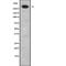 ATP Binding Cassette Subfamily A Member 12 antibody, abx147861, Abbexa, Western Blot image 