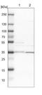 Glyoxylate And Hydroxypyruvate Reductase antibody, NBP1-83359, Novus Biologicals, Western Blot image 