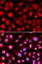 Ribosomal Protein L5 antibody, LS-C331799, Lifespan Biosciences, Immunofluorescence image 